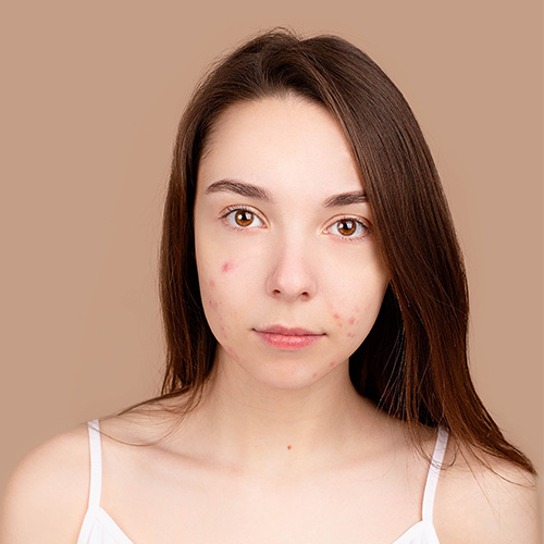 Correcció facial en fotos de carnet