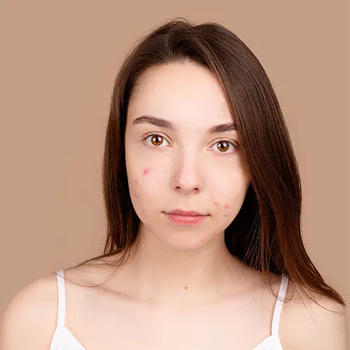 Correcció facial en fotos de carnet